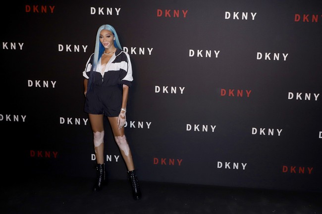 Hadir pula model Winnie Harlow. Ia tampil seksi dengan padanan jaket dan hot pants. (Foto: Getty Images)