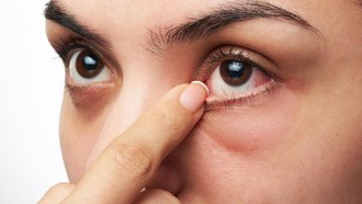 Gejala SePeLe Mata Kering Jangan Disepelekan, Atasi dengan Insto Dry Eyes