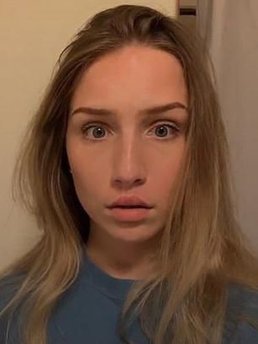 Viral Tren Tempel Bibir Pakai Lem Demi Tampil Seksi Seperti Kylie Jenner