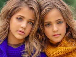 Pesona Gadis Kembar Tercantik Sedunia