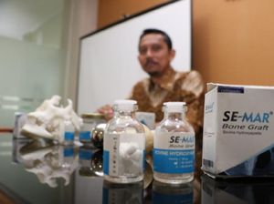 Tiga Dosen UNS Ciptakan Tulang Pinggul Tiruan Berbahan Titanium