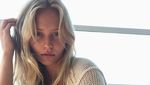 Cedera Usai Jatuh, Christie Brinkley Dianggap Cari Sensasi
