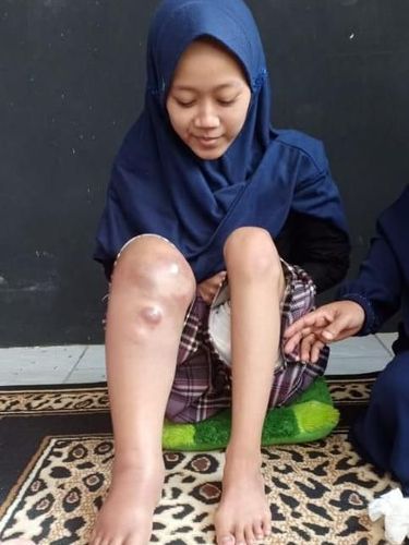 Viral Kesetiaan Pria Asal Bogor Dampingi Kekasih yang Sakit Tumor Ini Bikin Netizen Haru