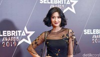 Fanny memiliki pesona yang membuat para pria jatuh hati. Pool/Noel/detikFoto.