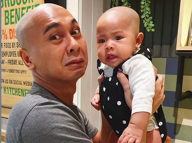 Sama-sama Gundul, Raditya Dika Pose Kocak Bareng Alinea