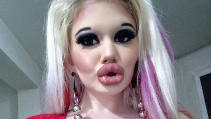 Andrea Emilova asal Bulgaria terobsesi punya bibir paling besar di dunia. Foto: Instagram/@andrea.andrea345 Andrea Emilova asal Bulgaria terobsesi punya bibir paling besar di dunia. Foto: Instagram/@andrea.andrea345