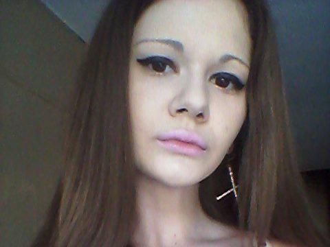 Suntik Filler 15 Kali, Wanita Bulgaria Ingin Punya Bibir Terbesar di Dunia