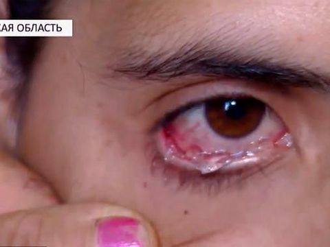 Wanita yang Viral Karena Keluar Air Mata Kristal Dituduh Membohongi Kondisinya 