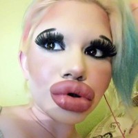 Aku merasa lebih baik jika mendapatkan bibir yang lebih lagi tapi sejumlah dokter mengatakan bahwa ini sudah cukup, tapi aku masih ingin lebih besar lagi, akunya seperti dikutip dari The Sun. Foto: Instagram/@andrea.andrea345