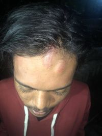 BEM Trisakti: 1 Mahasiswa Terluka Dipukul Polisi