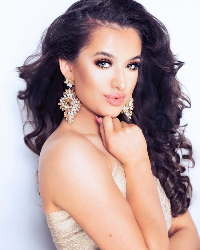 Wanita yang berencana ingin jadi polisi itu mengaku sebelumnya sempat sangat tidak percaya diri hingga tak ingin meninggalkan rumah. Asleigh pun akhirnya mengonsumi obat Roaccutane yang sebenarnya dapat memicu depresi dan pikiran bunuh diri. Foto: Instagram: @ashleighwild_