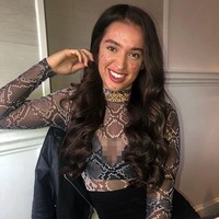 Miss Global England 2019 Ashleigh Wild pernah merasa dirinya jelek karena wajah yang berjerawat parah. Wanita 22 tahun itu pun memang sudah bergelut dengan problema kulit itu sejak 10 tahun. Kini wajahnya sudah jauh lebih mulus. Foto: Instagram: @ashleighwild_