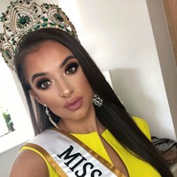 Kebanyakan ratu kecantikan punya wajah cantik dan mulus. Tapi Ashleigh Wild membuktikan ia pun tetap pantas jadi juara meski punya kondisi wajah berjerawat parah. Ashleigh pun sempat membagikan foto wajah tanpa makeup untuk mengingatkan orang-orang agar tak perlu mengikut standar kecantikan. Foto: Instagram: @ashleighwild_