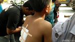 Miris! 2 Ruang Kelas SMPN 2 Plumbon Ambruk Timpa Siswa