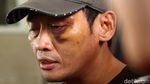 Babak Belur, Ninoy Karundeng Bicara Soal Penganiayaan Dirinya