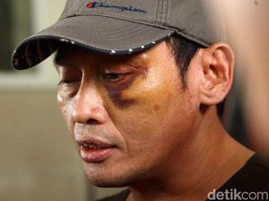 Ninoy Kenali Pelaku, PA 212 Teriak Halu