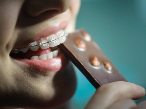 Pakai Kawat Gigi? Sebaiknya Hindari Konsumsi Makanan Ini