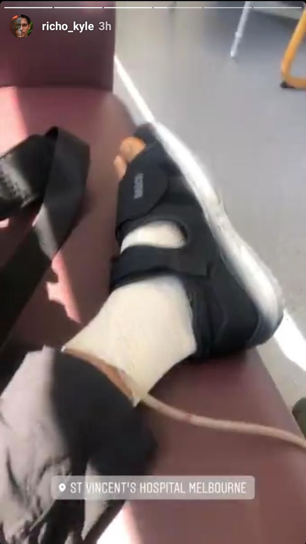 Pascaoperasi Richard Kyle Masih Pakai Alat Sedot di Kaki