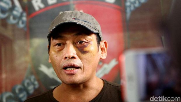 Temuan Mencengangkan dari Kasus Penyekapan Ninoy