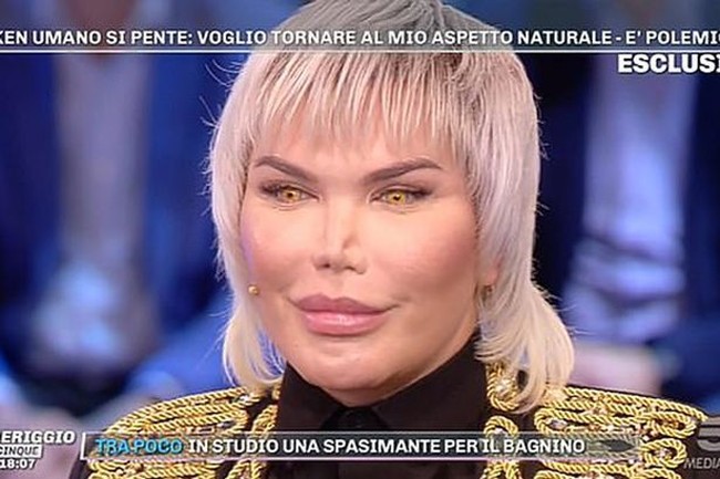 Terlalu banyak operasi plastik, hidung Rodrigo kini menyusut. saat menjadi tamu di acara TV Domenica Live, bentuk hidungnya terlihat tidak simetris. Bagian cupingnya mengecil dengan bentuk yang tidak rata kanan dan kirinya. Foto: Istimewa