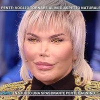 Terlalu banyak operasi plastik, hidung Rodrigo kini menyusut. saat menjadi tamu di acara TV Domenica Live, bentuk hidungnya terlihat tidak simetris. Bagian cupingnya mengecil dengan bentuk yang tidak rata kanan dan kirinya. Foto: Istimewa