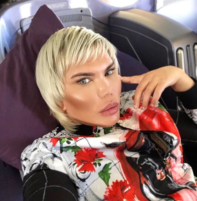 Pada 2017 silam, Rodrigo mengatakan bahwa setelah operasi hidung kedelapan kalinya, ia jadi kesulitan bernapas. Aku tidak bisa bernapas jadi aku harus operasi untuk memperbaiki pernapasanku, ungkapnya dalam acara The Morning.  Foto: Instagram