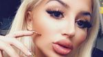 Penampilan Gadis Swedia Sebelum dan Setelah Terobsesi Jadi Barbie