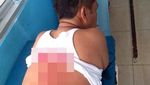 Momen Wiranto Ditandu di RSUD Pendeglang