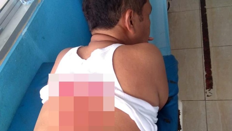 Polisi yang Ikut Ditusuk Bersama Wiranto Kapolsek Menes Kompol Dariyanto Polisi yang Ikut Ditusuk Bersama Wiranto Kapolsek Menes Kompol Dariyanto