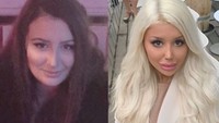 Ini penampilan Stefanie saat dirinya belum terlalu banyak dioprasi dan saat ini. Dok. Instagram/barbiestefii