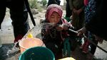 Potret Miris Anak-anak di Yaman yang Kelaparan dan Kekurangan Makanan