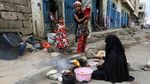 Potret Miris Anak-anak di Yaman yang Kelaparan dan Kekurangan Makanan