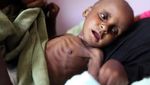 Potret Miris Anak-anak di Yaman yang Kelaparan dan Kekurangan Makanan