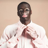 Moostapha merupakan model dengan kondisi kulit vitiligo. Vitiligo merupakan kondisi di mana kulit kehilangan pigmen atau melanin. Alhasil, warna kulit jadi tidak rata dan terlihat belang-belang. Pria asal Afrika Selatan ini membuat agensi model tertarik padanya karena kondisi kulitnya yang unik itu. Foto: Dok. Instagram