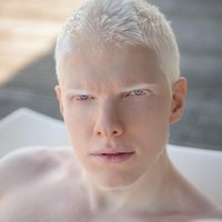 Bera Ivanishvli atau Bera adalah penyanyi dan pencipta lagu kelahiran Prancis. Kondisinya sebagai albino membuatnya terkenal. Dan Bera bukan satu-satunya albino di keluarganya. Adiknya Tsotne juga memiliki kelainan kulit yang sama. Foto: Dok. Instagram
