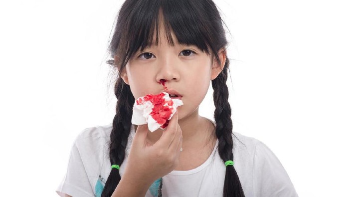 Asian girl with bleeding from the nose on white background isolated