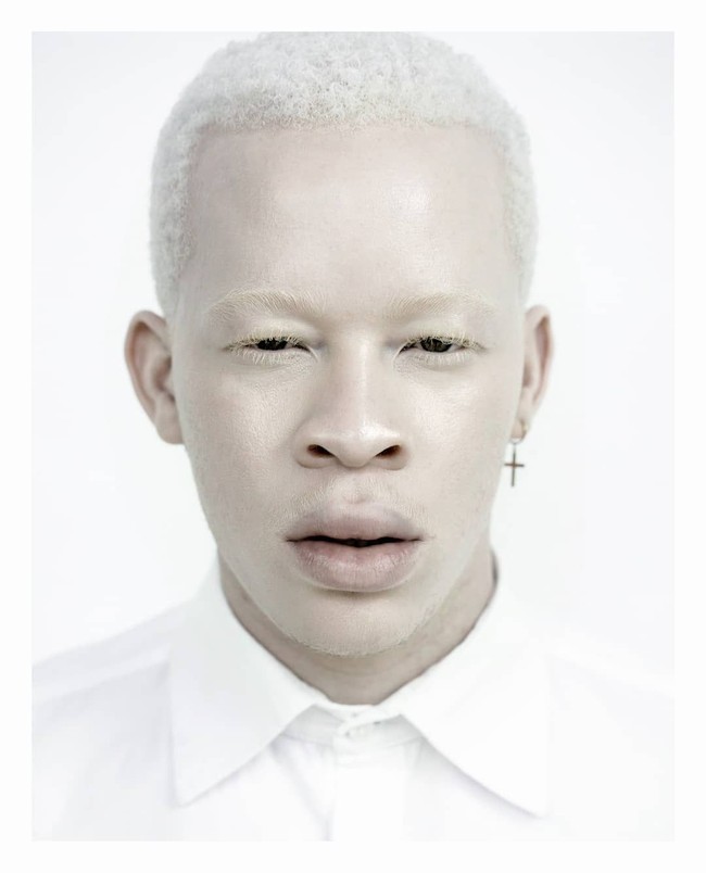 Sanele terkenal sebagai model albino. Pria dengan nama lengkap Sanele Junior Xaba ini menggunakan popularitasnya untuk menarik perhatian kehadiran para albino di industri fashion. Menurutnya, albino belum dipandang setara dengan model pada umumnya. Albino hanya digunakan pada pemotretan yang bertema unik bukan kampanye fashion biasa. Foto: Dok. Instagram