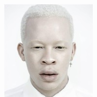 Sanele terkenal sebagai model albino. Pria dengan nama lengkap Sanele Junior Xaba ini menggunakan popularitasnya untuk menarik perhatian kehadiran para albino di industri fashion. Menurutnya, albino belum dipandang setara dengan model pada umumnya. Albino hanya digunakan pada pemotretan yang bertema unik bukan kampanye fashion biasa. Foto: Dok. Instagram