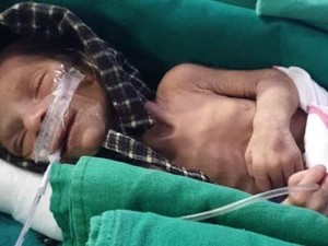Bayi Perempuan Hidup Walau Sudah 2 Hari Dimasukkan ke Liang Kubur di India