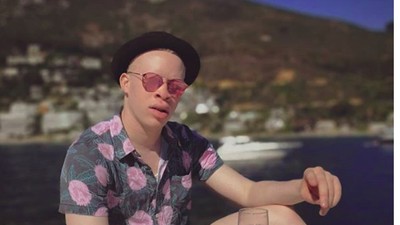 Potret Liburannya Model Albino, Sanele Junior Xaba