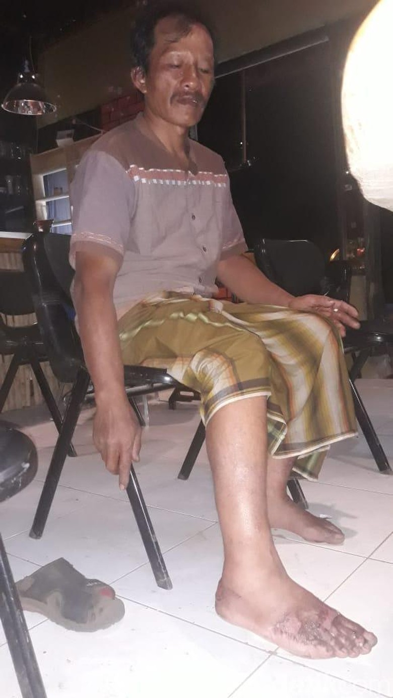 Terperosok Lubang Bara, Kaki Pemadam Kebakaran Gunung Ringgit Melepuh Terperosok Lubang Bara, Kaki Pemadam Kebakaran Gunung Ringgit Melepuh