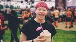 Potret Liburannya Model Albino, Sanele Junior Xaba