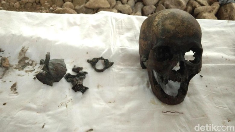 Ahli Forensik Gigi Unpad Teliti Tengkorak Misterius di Indramayu Ahli Forensik Gigi Unpad Teliti Tengkorak Misterius di Indramayu