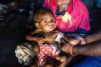 Mie Instan Menyebabkan 40% Anak Dibawah Umur di Asia Alami Malnutrisi