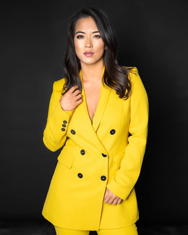 Meski terasa sakit dan membuat tak percaya diri, ia justru bersyukur bisa mengalami ini. Sebagai seseorang yang tidak pernah mengalami masalah kulit sebelum aku tidak pernah bisa mengerti. Tapi sekarang aku akan lebih mengerti dan empati dan untuk itu aku bersyukur, ujarnya. Foto: Instagram @franceswangtv