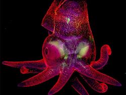 Foto Menakjubkan Pemenang Kontes Dunia Mikroskopis