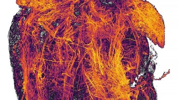 Pemenang ranking 20: Blood Vessels Of A Murine Heart (pembuluh darah jantung tikus) oleh Simon Merz, Lea Bornemann & Sebastian Korste, Jerman. Foto: Nikon