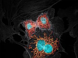 Foto Menakjubkan Pemenang Kontes Dunia Mikroskopis