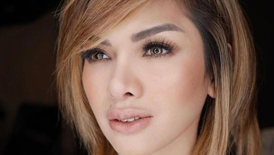 Foto: Wajah Nikita Mirzani yang Mengaku Operasi Plastik Rp 1,1 Miliar