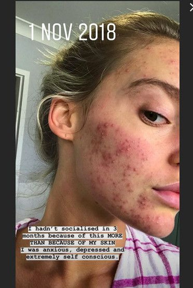 Georgia lebih banyak makan sayur dan buah. Dia tidak makan biji-bijian, makanan pengawet, kafein, gula untuk mengatur ulang ususku. Foto: Instagram